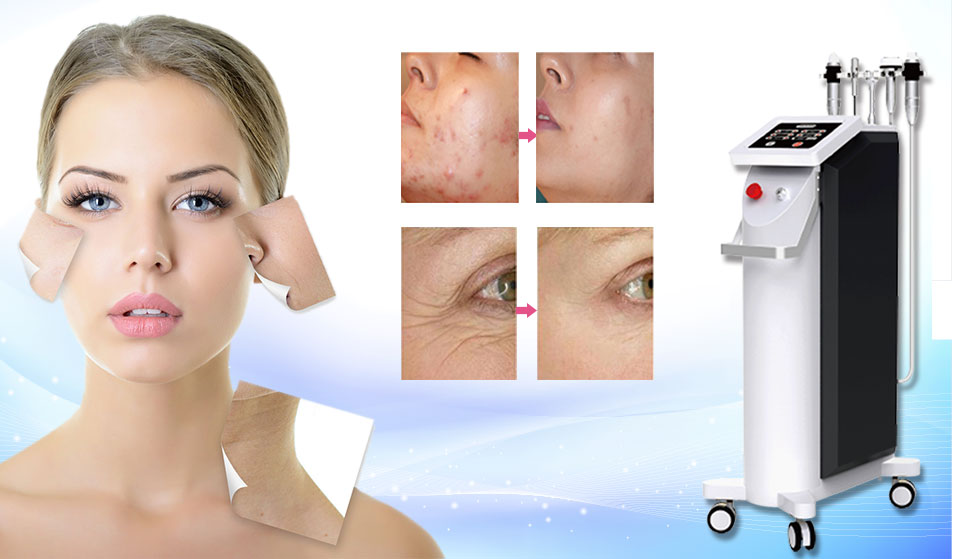 Vertical Microneedle Fractional RF Machine.jpg
