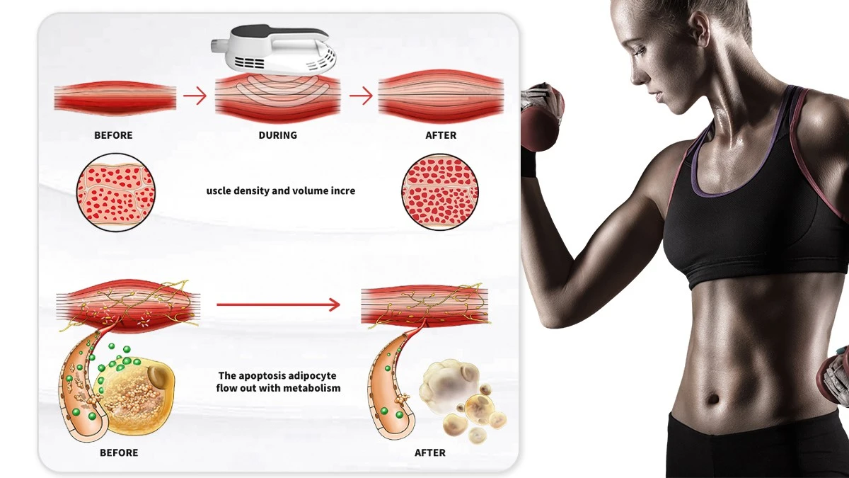MAGSHAPE Portable EMS Muscle machine MAGSHAPEMAGSHAPE Portable EMS Muscle machine