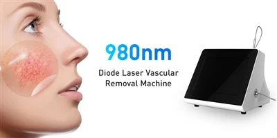 Dapatkan Kulit Sempurna dengan Laser Dioda 980nm: Wawasan Industri dan Keuntu...
